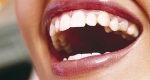 چگونه دندان هایی سفید و زیبا داشته باشیم؟